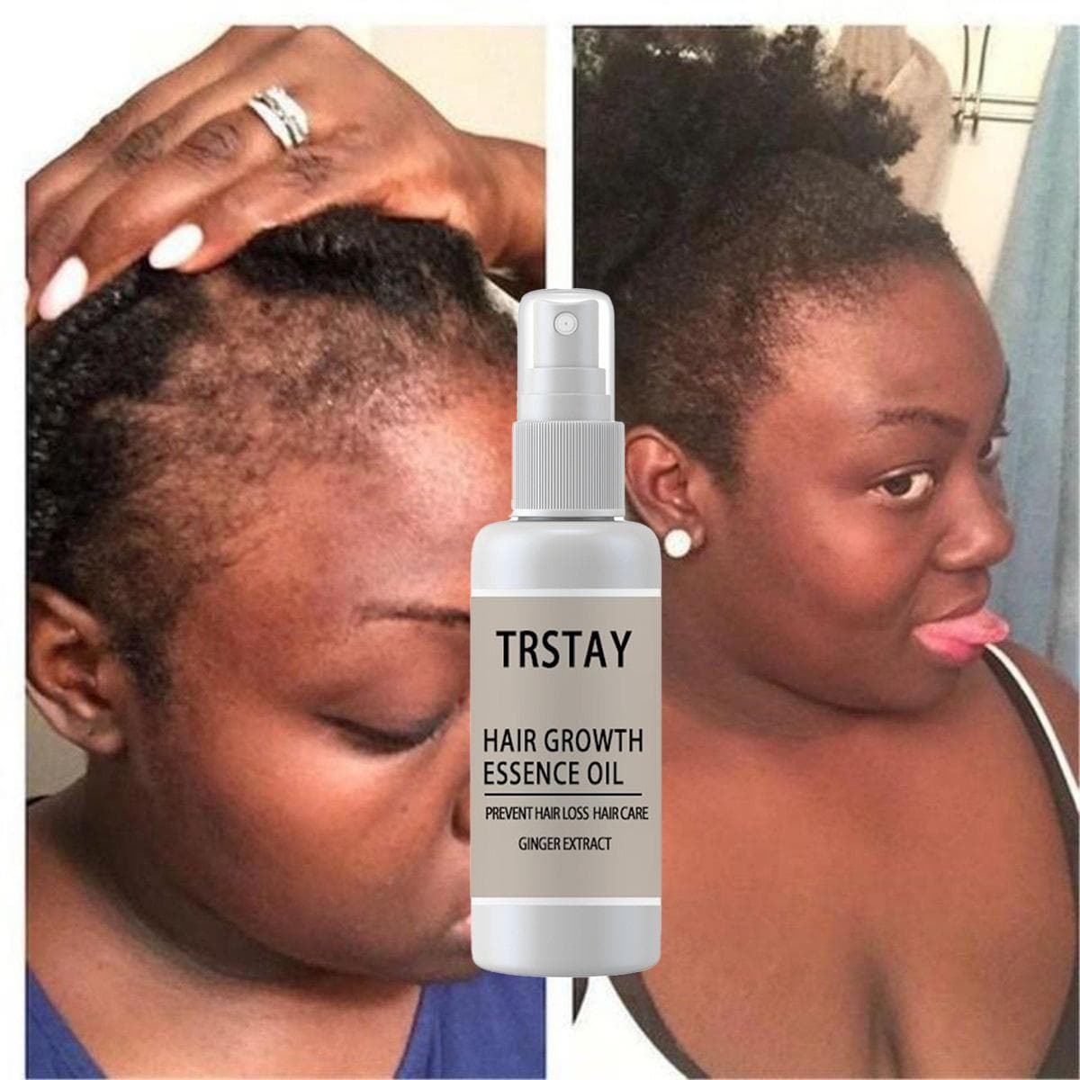 Hair Growth Serum / Fast Hair Growth Product 5ml