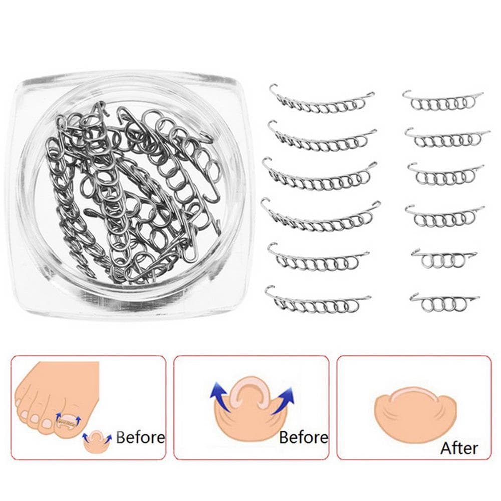 12PcsBox Ingrown Toenail Correction Wire Fixer 6 Sizes Ingrown Toe Corrector Pedicure Treatment