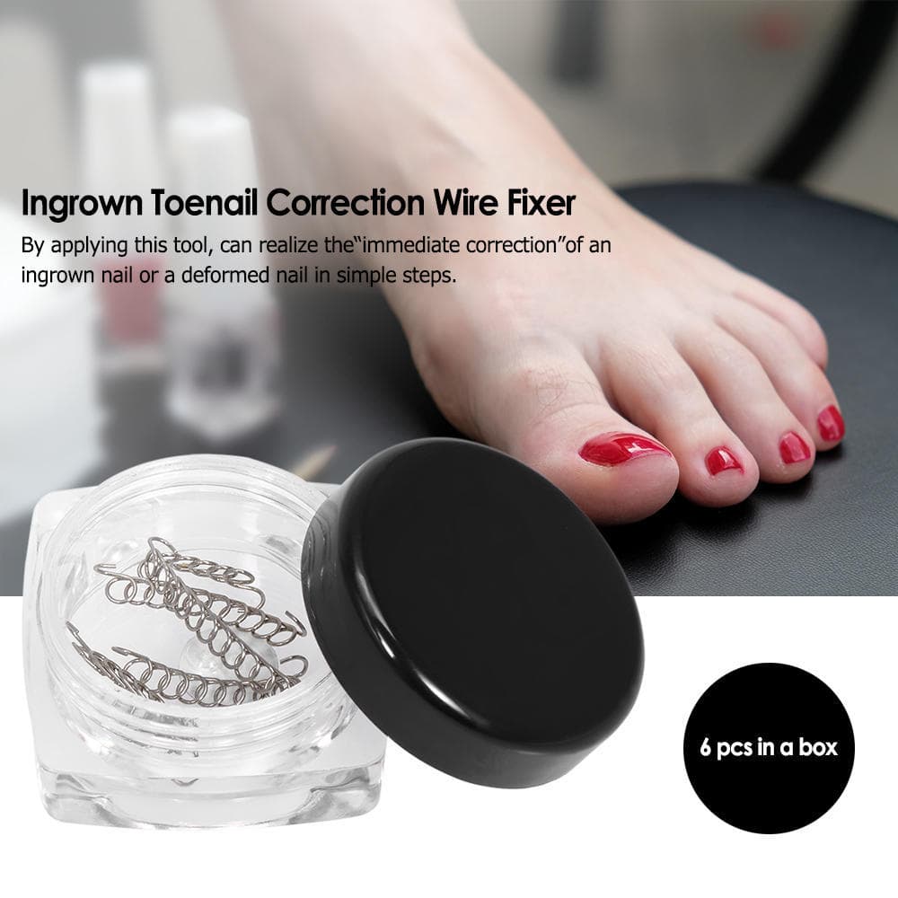 6Pcs Ingrown Toenail Correction Wire Fixer Ingrown Toe Corrector Pedicure