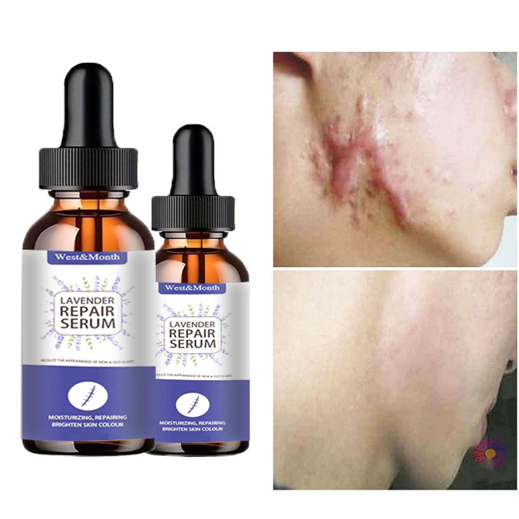 5ML/15ML/30ML/50ML/Lady Face Whitening Cream Dark Skin Spots Scars Cream Day Night Face Cream Skin Whitening korean skin care products 30ml