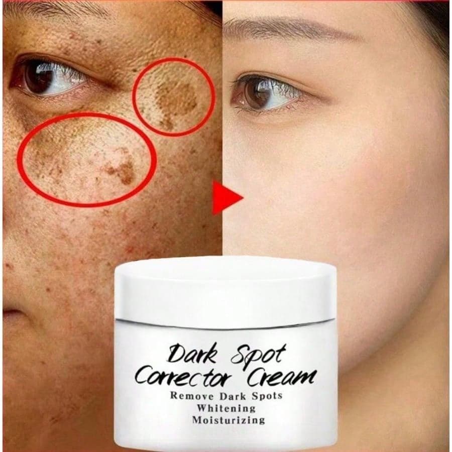 Newest Dark Spots Corrector Cream Whitening Facial Cream Repair Fade Freckles Remove Dark Spots Melanin Remover Brightening Face Cream 60G