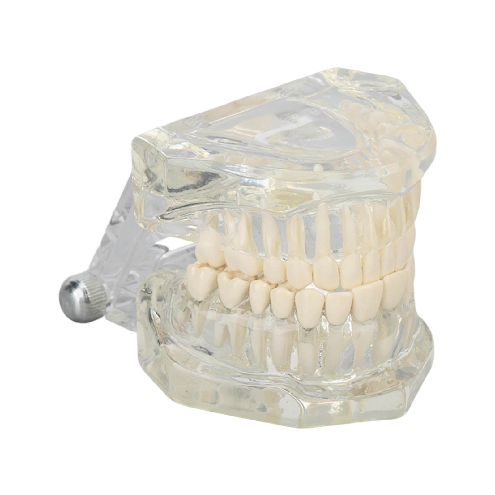 Transparent Dental Model Clear Structure Educational Dental Teeth Display Model for Dental Clinic