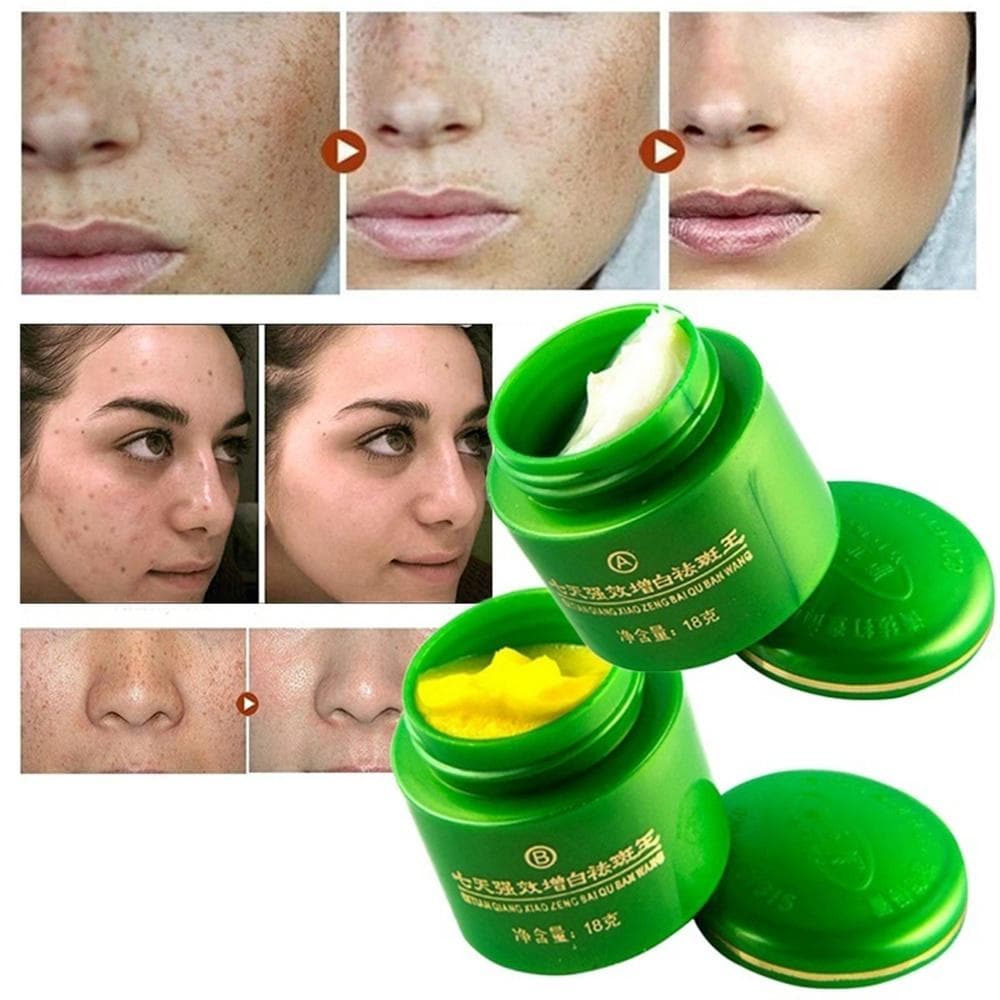 2pcs/Set Face Whitening Cream Brightening Freckle Dark Spot Corrector Removal Fade Blemish Skin Care One Size