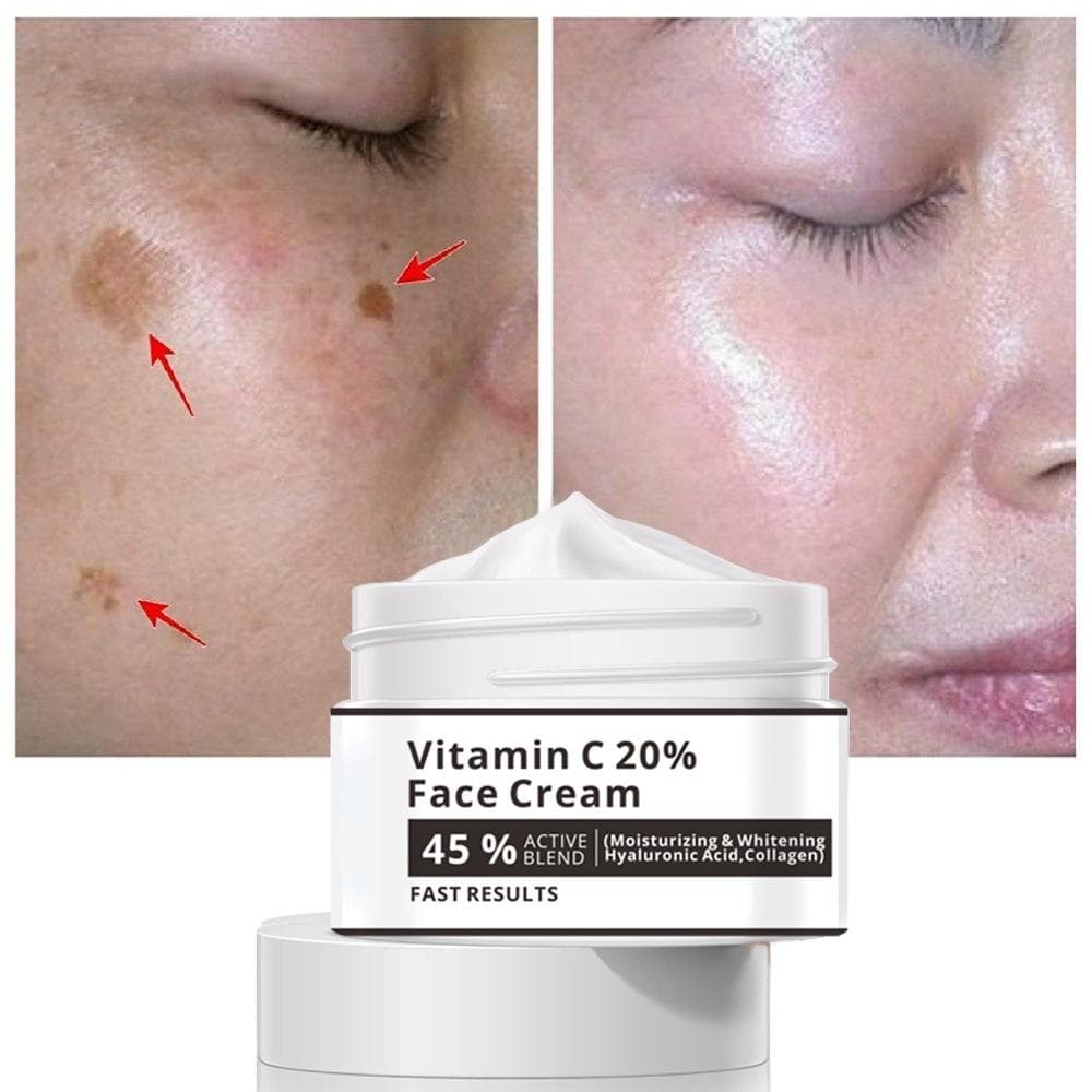 Effective Whitening Freckle Cream Remove Melasma Acne Spot Pigment Melanin Dark Spots Pigmentation Moisturizer Skin Care 50G