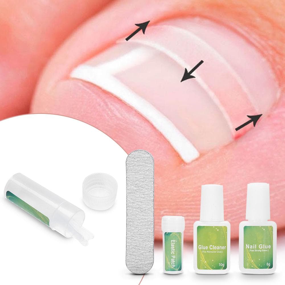 Professional Pedicure Tool Set Toe Nail Trimer Ingrown Toenail Correcction Fixer Foot Care