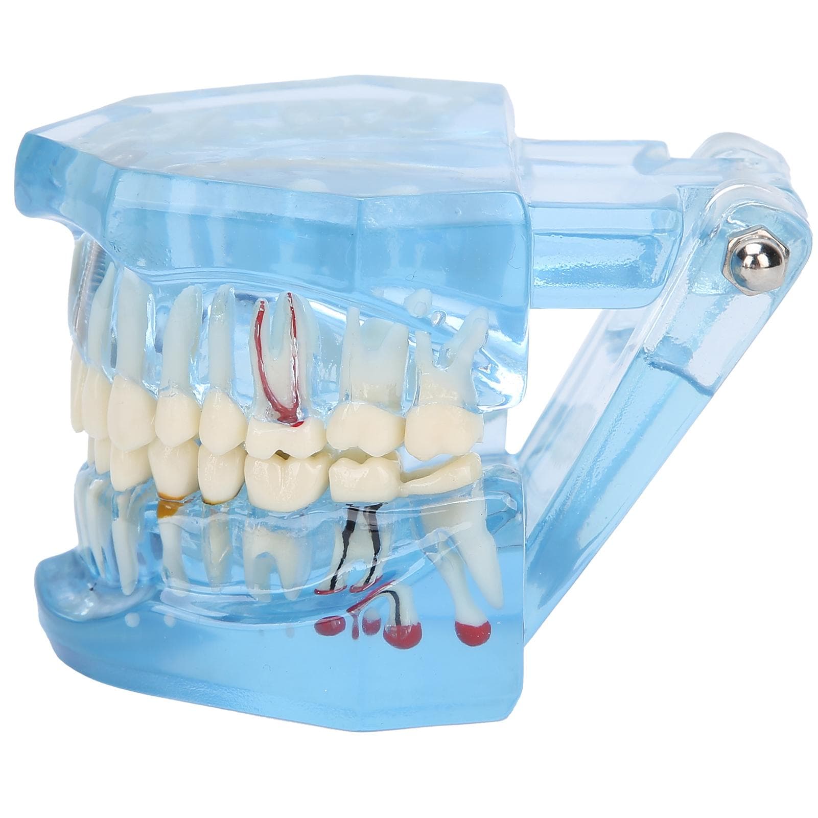 Dental Teeth Model Acrylic Blue Transparent Teaching Demonstration Simulation Teeth Model