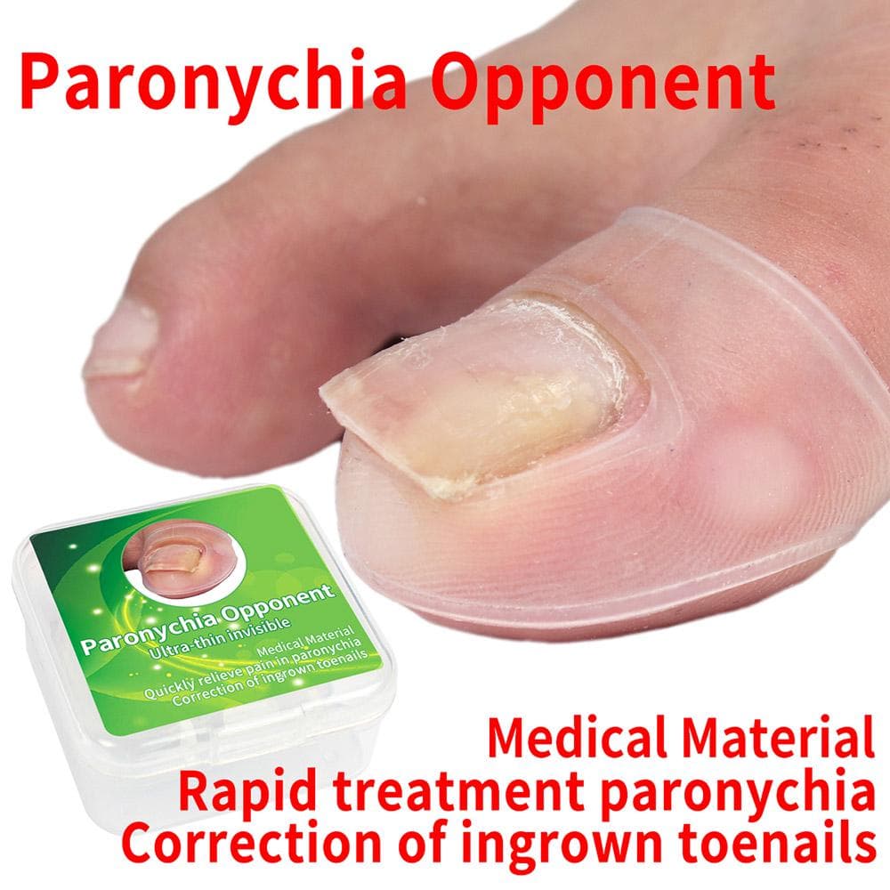 2PCS Ingrown Toenail Correction Tool Toe Cap Toenail Protector Big Toe Sleeves Thick Paronychia white