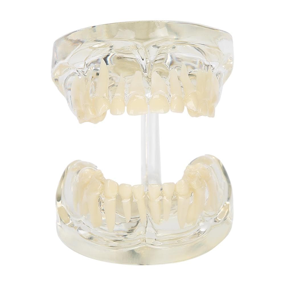 Dental Deciduous Teeth Model Removable Teeth Model Teaching Tool for Dentist