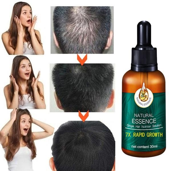 Hair Growth Essence, Hair Care Products, Hair Essence, Fast Hair Growth, Nourishing Hair, Moisturizing And Softening Hair Quality 30 ML(No Box)