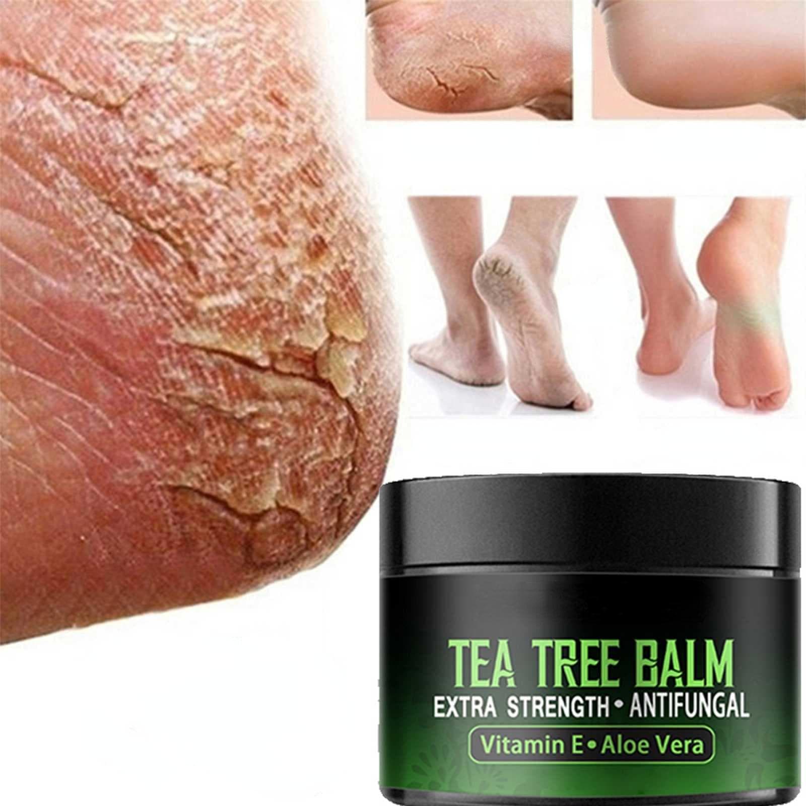 Anti-Drying Crack Foot Cream Heel Cracked Repair Cream Removal Dead Skin Hand Feet Care Hand and Foot Skin Care 60G