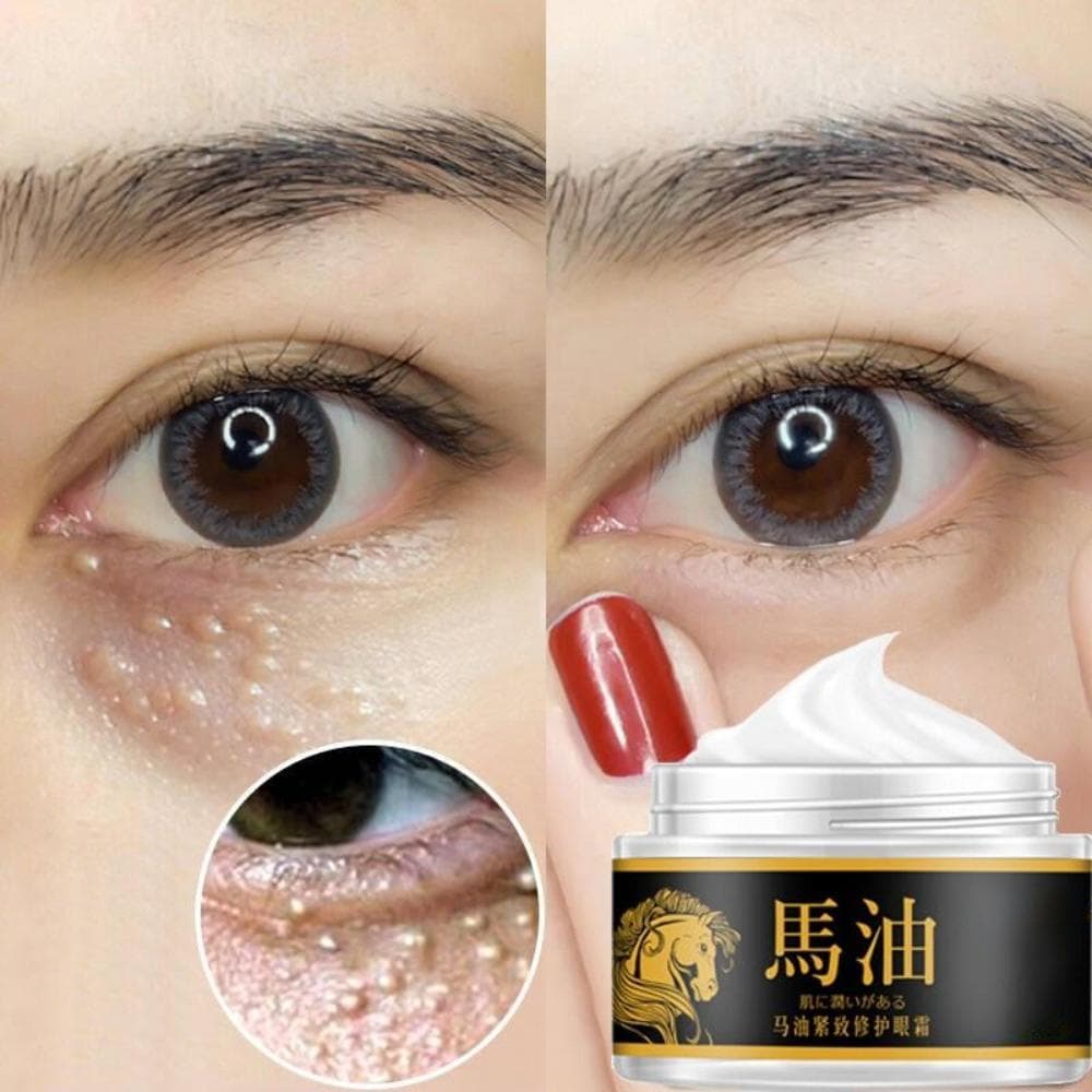 Horse Oil Firming Eye Cream for Dark Circles&wrinkles& Fat Granule & Anti-aging Eye Essence Remove Dark Circles Eye Cream(5g/15g/30g/50g) 15G