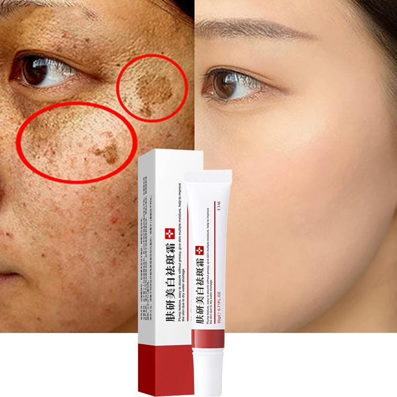 Dark Spot Corrector Skin Whitening Fade Cream Lightening Blemish Removal Serum Reduces Age Spots Freckles Face Cream 20g