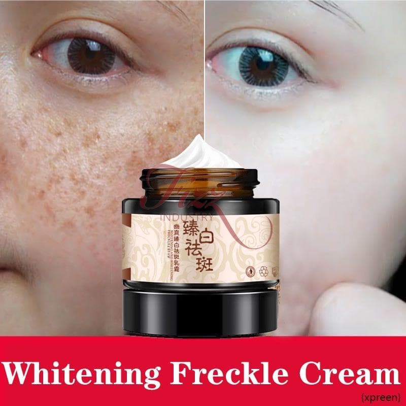 Powerful whitening freckle cream plant face cream remove freckles and dark spots 30g 5G