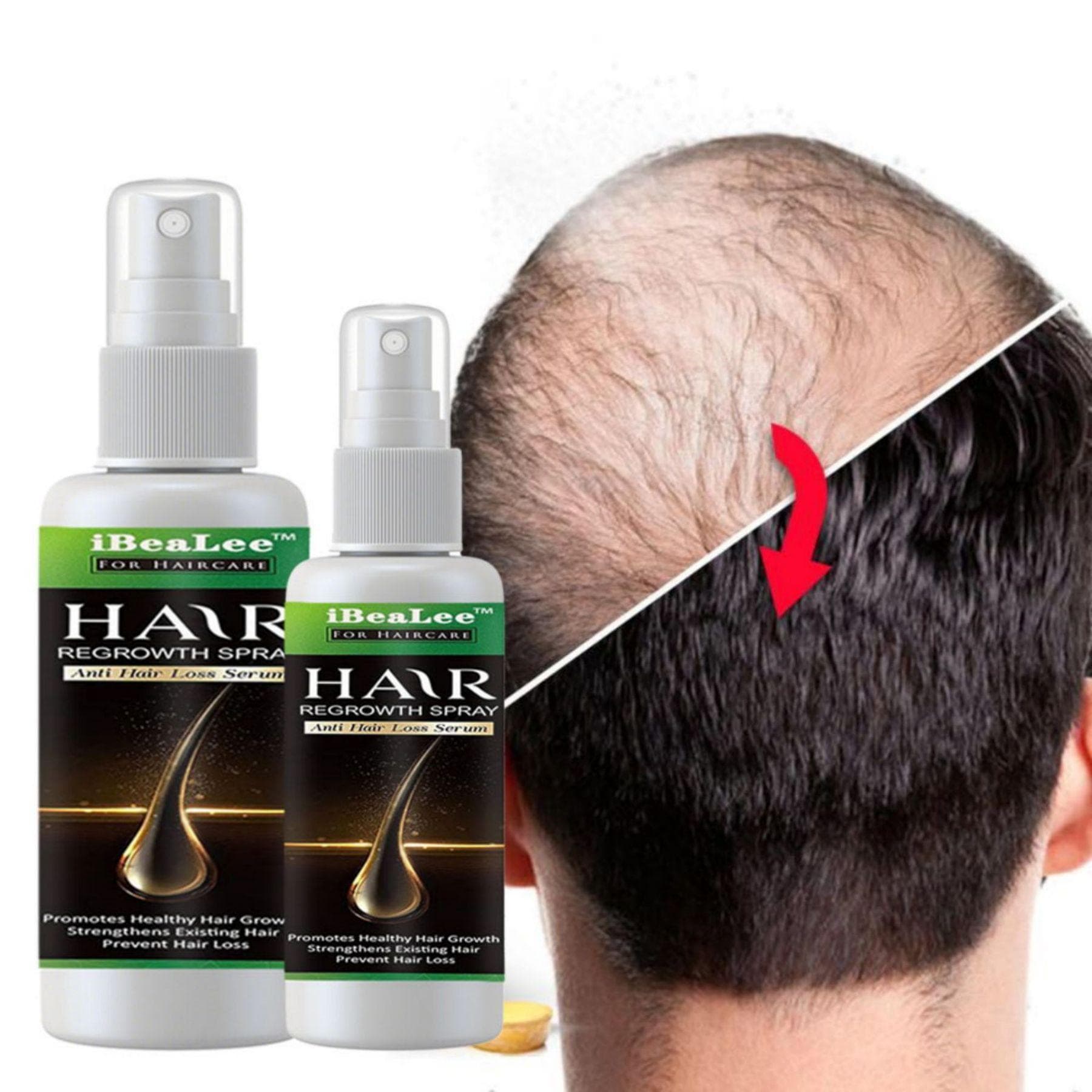 Fast Hair Growth Serum Conditioner Anti-Hair Loss Serum Improves Hair Follicles Nourishes Hair Roots Thick Hair 30ml