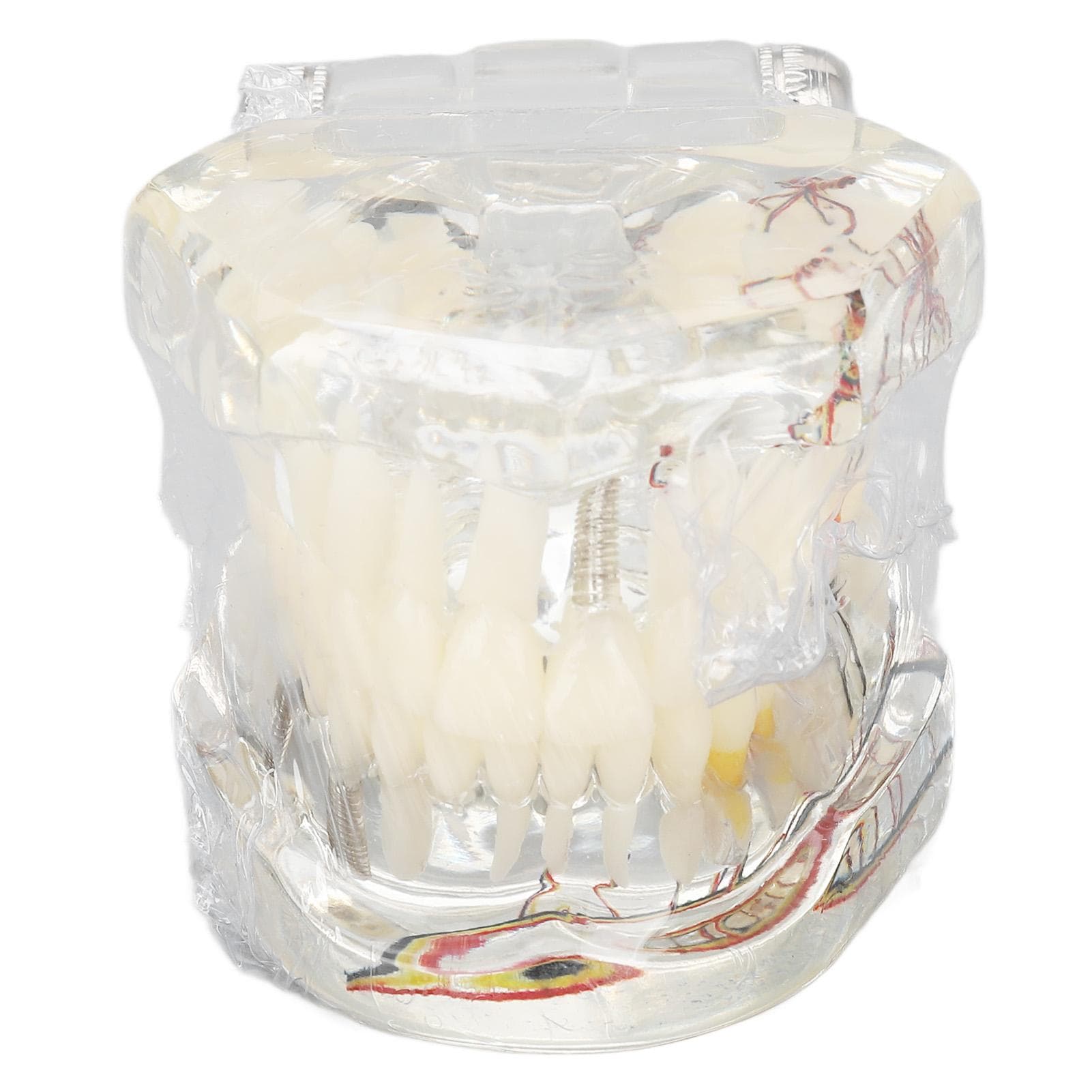 Disease Teeth Model Portable Acrylic Teaching Dental Implant Teeth Model for Clinic Transparent