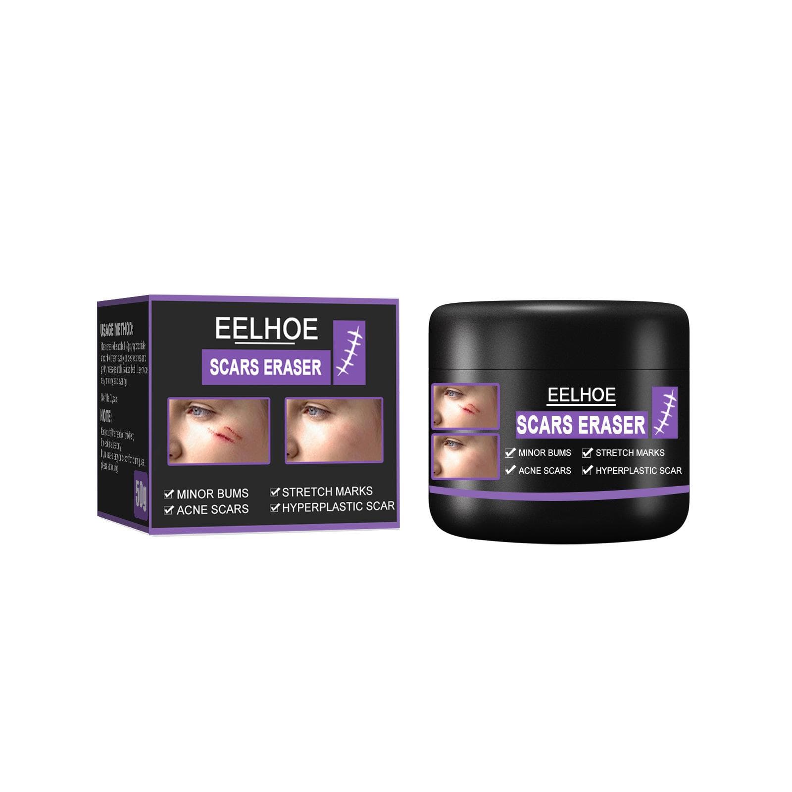 eelhoe Scar Removal Cream Gel Remove Acne Spots Treatment Stretch Marks Burn Surgical Scar Repair Cream Smoothing Whitening Skin Beauty 50g 50g
