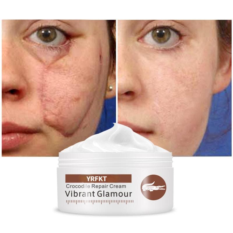 Crocodile Repair Scar Acne Cream Facial Treatment Repair Cream Stretch Marks Treatment Whitening Day Creams 50G